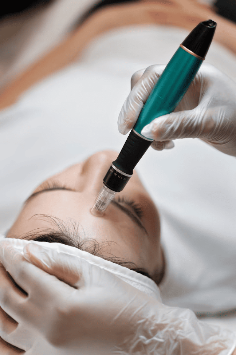Mesotherapie